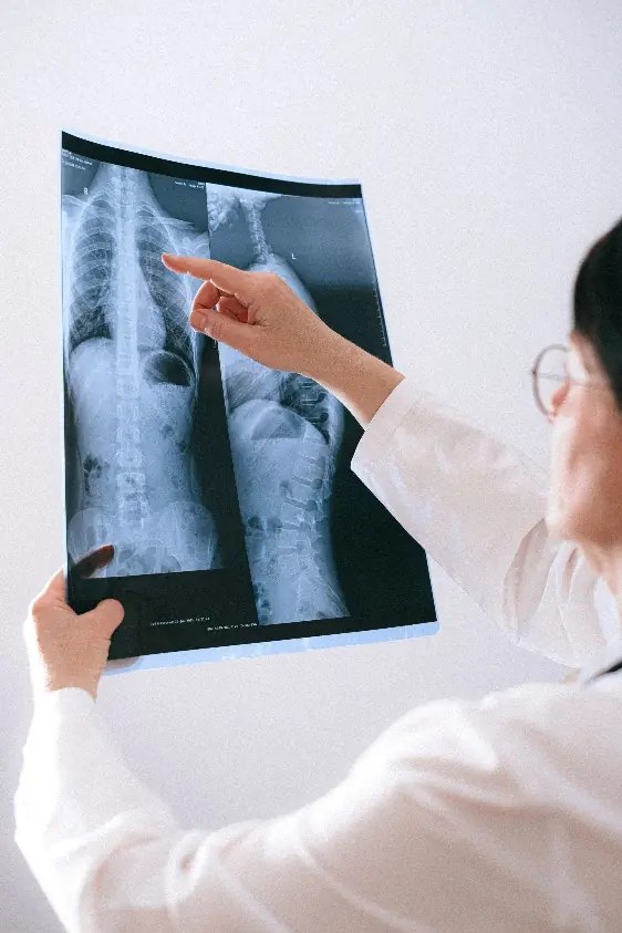 Radiologist reviewing chest X-rays during a diagnostic imaging discussion